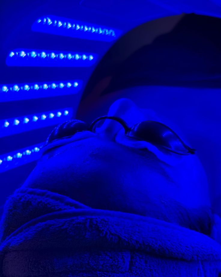 Benefits of Blue Light LED Therapy used in the Deluxe HydraFacial to target acne and bacteria