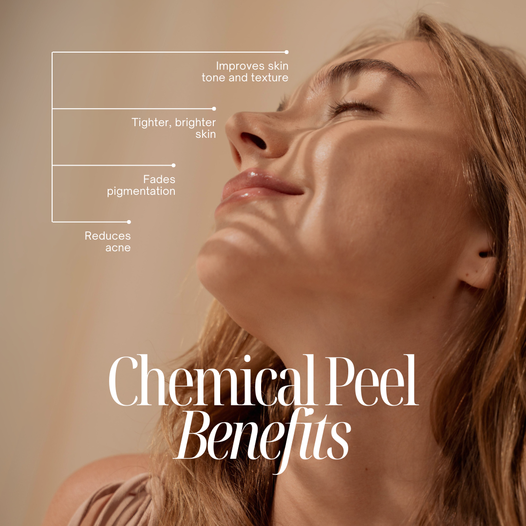 Professional medical-grade chemical peel solutions used at The Skin Tune